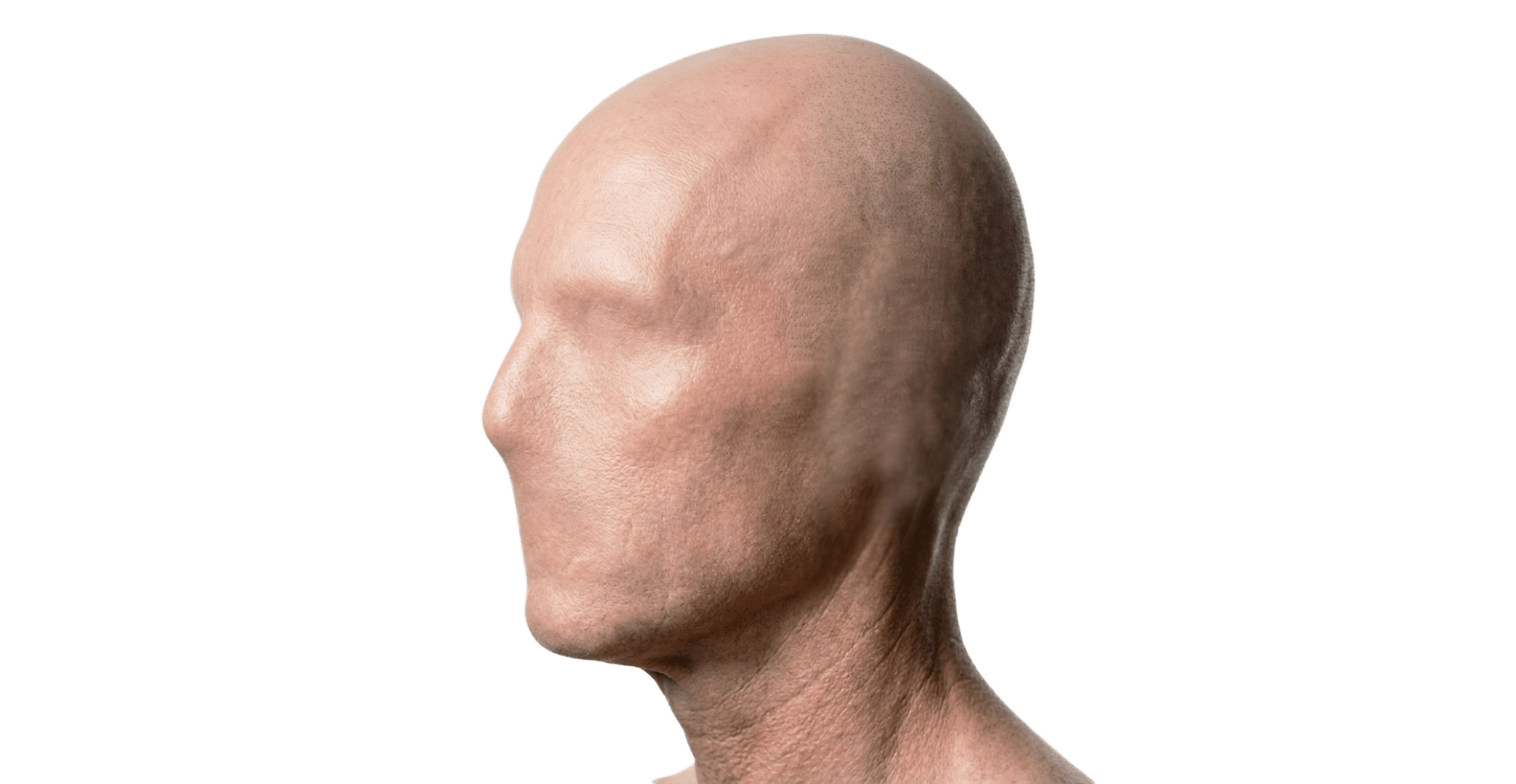 Detall tors lateral