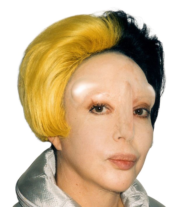 ORLAN