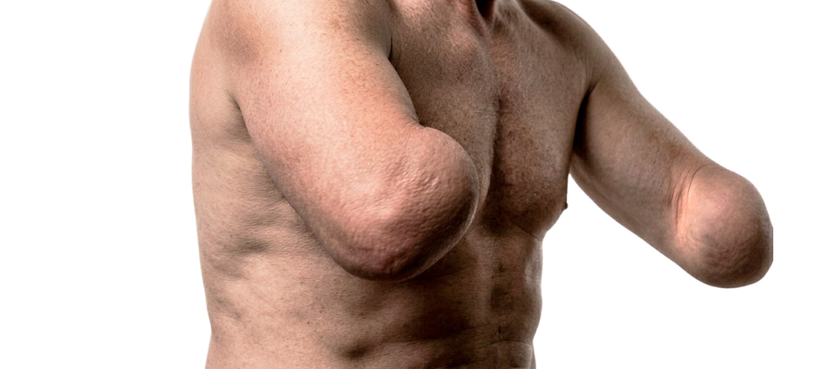 Perfil posterior cap